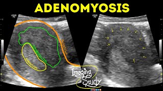 How Does Ultrasound Work [upl. by Lenoj]