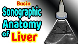 Abdominal Ultrasound Guidelines for best reporting [upl. by Clarence]