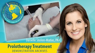 One minute Mortons Neuroma treatment with Prolotherapy [upl. by Oneladgam676]