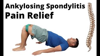 Ankylosing Spondylitis exercises for pain relief [upl. by Akiner]